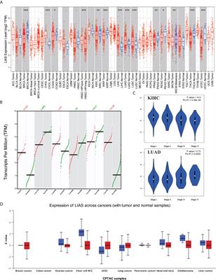 Comprehensive analysis of the potential cuproptosis-related biomarker LIAS that regulates prognosis and immunotherapy of pan-cancers